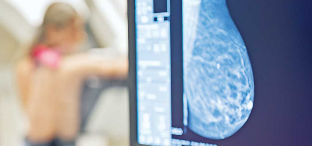 Mammogram on Screen