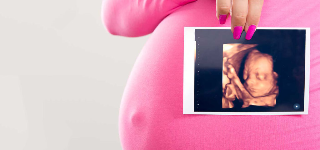 3D Ultrasound Photo