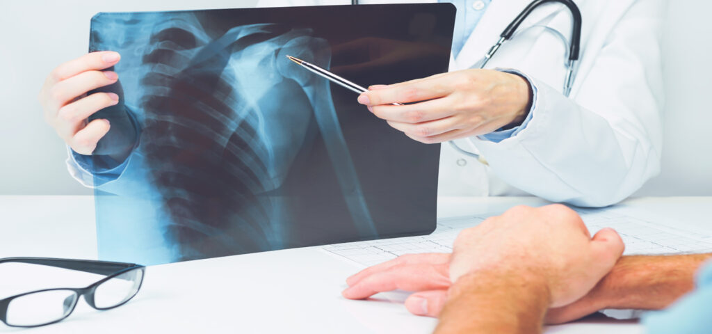 What Does a DEXA Scan Do